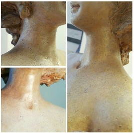 Restoration of broken neck
